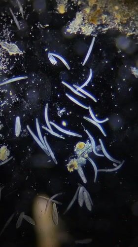 Microscopic worm-like organisms observed in Ribeira Grande, Portugal
