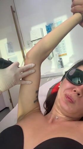 Woman receives laser hair removal treatment in Dubai clinic