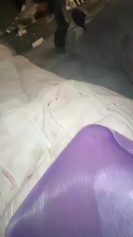 The video shows two people lying on a surface. Both have blood around their faces. One person is wearing a white jumpsuit covered in blood, and the other is wearing a green and yellow safety vest. The environment appears to be an industrial setting, with metal structures visible above. A purple object is near the person in the jumpsuit.
