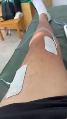 A video shows a person lying on a medical examination table with two white square electrodes attached to their leg via blue wires. The person has dark hair on their legs. The background includes other people sitting in a waiting room, some with their feet in braces or casts. They are looking at their phones. There are also several small wooden chairs and a backpack in the background.