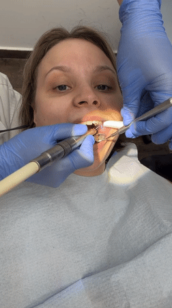 Dental procedure documented in Rishon LeZion, Israel