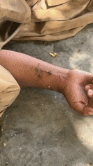 Person lying on ground in Quetta, flies present nearby