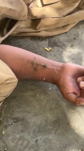 Person lying on ground in Quetta, flies present nearby