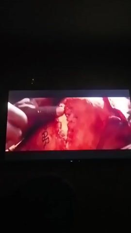 A close-up shot shows the face of a man with dark skin, looking towards the camera. He appears to be in distress. The lighting is dim, with a red hue dominating the scene. There is some blurry, reddish material in the background, possibly indicating a chaotic or bloody environment. The man's expression suggests he is experiencing pain or fear. Some text is visible on a surface in the foreground, but it is not clearly legible. The overall impression is one of a dramatic and possibly violent situation.