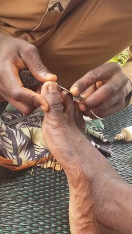 This is a close-up, top-down video of a person's hands performing a pedicure on another person's foot. The focus is on the toe and the tools being used. The person on the left, wearing a tan garment, is using metal instruments to trim and clean the toenail of the person on the right. The foot appears to be dark-skinned, with visible lines and texture on the skin. The toenail being worked on is light-colored and appears to be intact.

The setting seems to be outdoors, as suggested by the hint of green foliage in the upper left corner and the natural lighting. The ground is covered with a woven mat in a green and black pattern, and a colorful patterned fabric is placed under the foot. A small, white bottle, possibly containing antiseptic or lotion, is visible in the upper right corner. The overall mood appears to be one of focused care and attention to detail. There is no visible text in the media. The activity is a personal grooming ritual, likely taking place during daylight hours given the brightness of the scene.