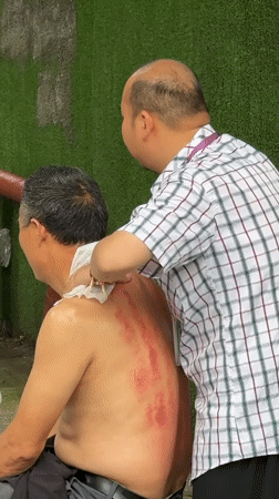 Outdoor back treatment session observed in Yuzhong District