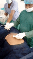 Medical team performs abdominal surgery procedure