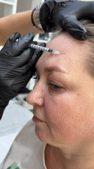 Medical professional performs facial cosmetic injections on multiple patients
