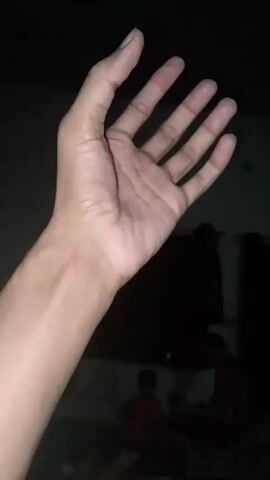 A video shows a close-up of a person's left hand and forearm. The hand is shown in various positions, including open and closed. The background is dark, with some blurry figures in the distance. It appears to be indoors, possibly a room.