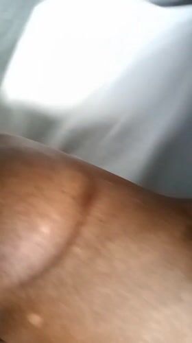 Cupping therapy session documented in Nigerian suburbs