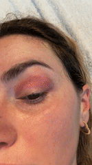 Person with facial injury documented at Manchester indoor pool