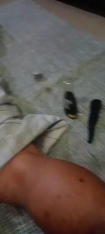 The video shows a person lying down with their back exposed, revealing red marks or welts across their back. A patterned cloth is draped over their lower body. In the foreground, a bottle with dark liquid and a black object are visible on a textured surface. The lighting is dim.