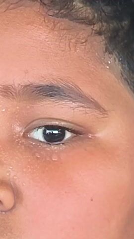The video shows a close-up of a child's face, focusing on their eyes, nose, and forehead. The child has tan skin and dark hair. The skin on their face is covered in small droplets of water, possibly sweat. The child looks to the side in the video.