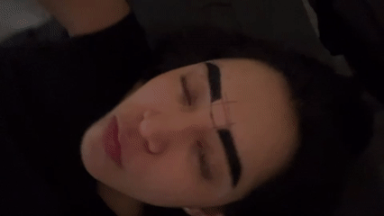 Woman undergoes apparent eyebrow procedure in Puebla, Mexico