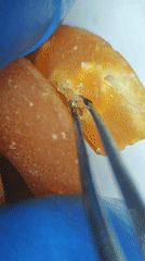 Fruit grub extracted and examined under microscope in Portugal