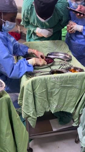 Surgery performed at Nairobi medical facility