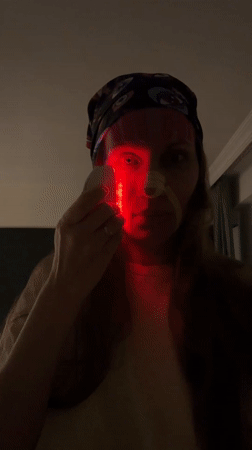 Woman documents facial therapy and wellness routine in Turkey