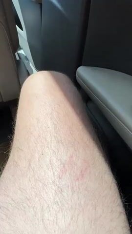 This video shows a close-up view of a person's leg with some red marks on it. A hand with painted fingernails is resting on the leg. The background suggests an indoor setting, possibly a car interior, with a gray seat or armrest visible. The lighting indicates it is daytime. The red marks on the leg are faint and appear to be superficial. There is no visible text in the video.