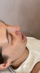 Medical procedure underway in Izhevsk clinical setting
