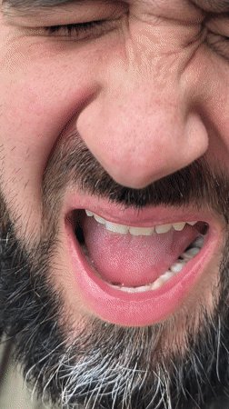 Person filmed using mouth spray in Hrodna, Belarus