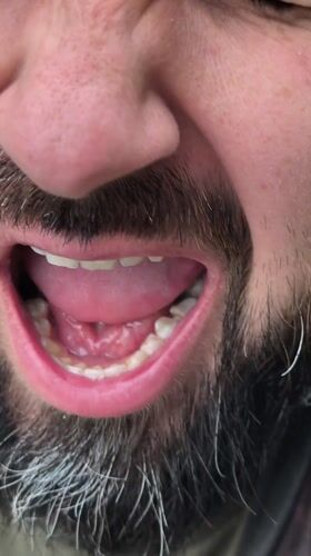 Person filmed using mouth spray in Hrodna, Belarus