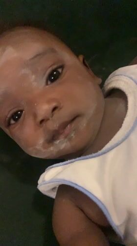 Baby with white powder observed in Barakin Akawo, Nigeria