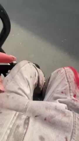 The video shows two people sitting in the back of a golf cart. Both are covered in what appears to be fake blood on their faces and clothing. The woman is laughing and the man is looking off to the side. The person holding the camera is rotating the camera to show the scene.