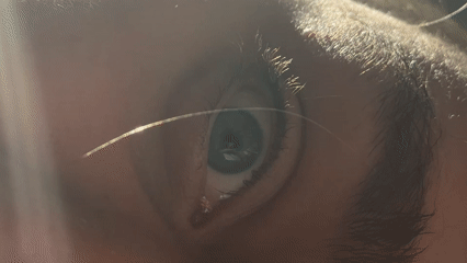 Close-up eye recording captured in Perm with reflective line