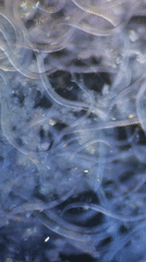 Microscopic organisms observed in laboratory fluid sample