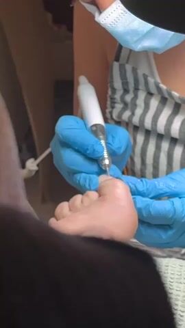 A close-up shot shows a person wearing blue disposable gloves and a mask performing a pedicure on a foot. The person is holding a white electric nail file with a metal tip and is working on the toenail of the big toe. The foot appears to be resting on a white towel or mat. Another person's shoulder and arm, wearing a black garment, are visible in the foreground. The background is out of focus but suggests an indoor setting, possibly a salon. The lighting is bright, highlighting the area of work.