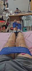 Medical patient shows positive signs during treatment in Denpasar