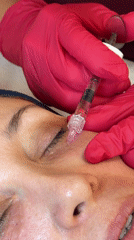 Woman receives cosmetic injections at Sofia clinic