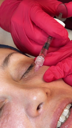 Woman receives cosmetic injections at Sofia clinic