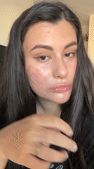 Woman with facial markings observed in Kiryat Bialik