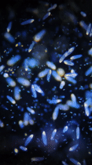 Microscopic organisms observed in laboratory examination