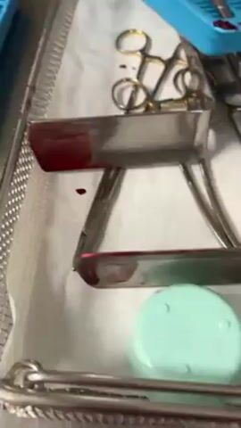 The video shows a metal tray with surgical instruments covered in blood. A separate blue tray also contains blood-covered surgical instruments. A white basin is filled with water and a reddish-pink substance that appears to be blood. The camera moves around the basin, showing its exterior.