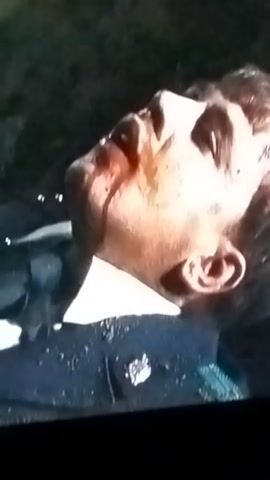 The video displays a close-up, low-resolution shot of a person lying down, seemingly injured. Blood is visible on the person's face, particularly around the mouth and nose. The person is wearing a dark uniform with a white collar and some insignia on the left chest. The background appears to be outdoors, possibly with foliage or dark, uneven ground. The lighting is dim, and the image quality is poor, with visible video artifacts. There is a white star symbol visible in the upper right corner of the frame in some segments. The audio consists of indistinct speech and background noise.