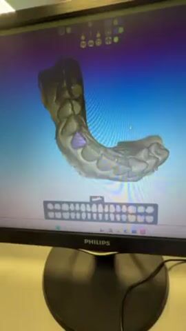 The video shows a close-up view of a Philips computer monitor displaying a 3D dental model. The model appears to represent a lower jaw with teeth, with one tooth highlighted in purple. A grid of tooth shapes is visible below the model. The computer monitor has a black base and a Philips logo on the bottom bezel.