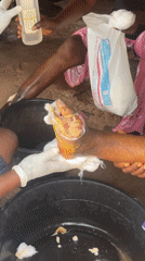 Wound care treatment for infected foot in Enugu, Nigeria