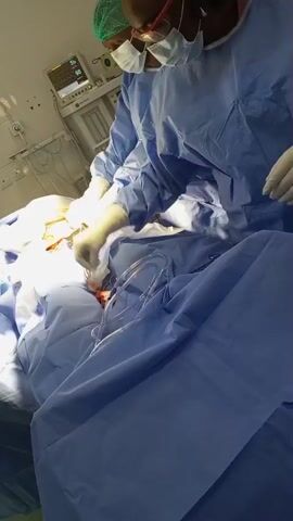 Two individuals wearing surgical scrubs, masks, and surgical caps are engaged in a surgical procedure. One individual, positioned on the left, is actively working with instruments on a patient who is draped in blue surgical sheeting. The other individual, on the right, appears to be assisting or observing the procedure. A patient monitor is visible in the background, displaying vital signs. The environment appears to be an operating room.