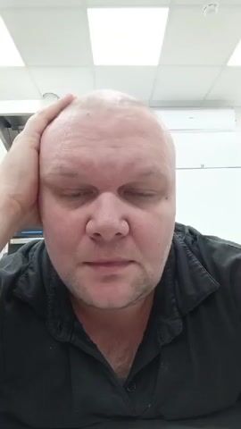 The video is a close-up, head-and-shoulders shot of a bald, fair-skinned man with blue eyes. He is wearing a black collared shirt. The man's left hand is on the top of his head. His mouth is open as if he is speaking or reacting to something. The background is a brightly lit room, likely an office or commercial space, with white ceiling tiles and some unseen equipment or fixtures. The lighting appears to be from overhead fluorescent lights. The video has a static camera angle and no other people or objects are visible in the frame.