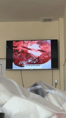 Mixed memories captured in Plovdiv: medical TV, cityscape, sleeping dog