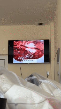 Mixed memories captured in Plovdiv: medical TV, cityscape, sleeping dog