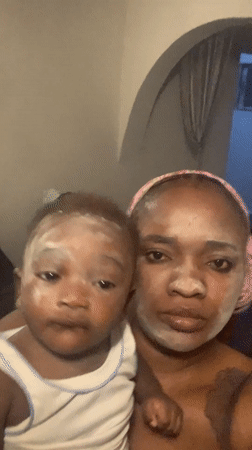 Mother and baby share facial treatment routine in Nigeria