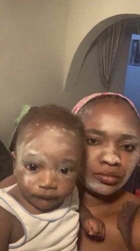 Mother and baby share facial treatment routine in Nigeria
